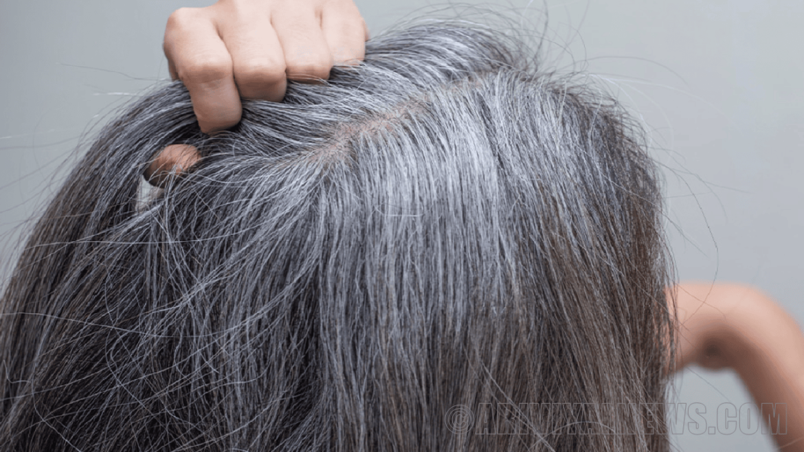 Root cause of aging scalp