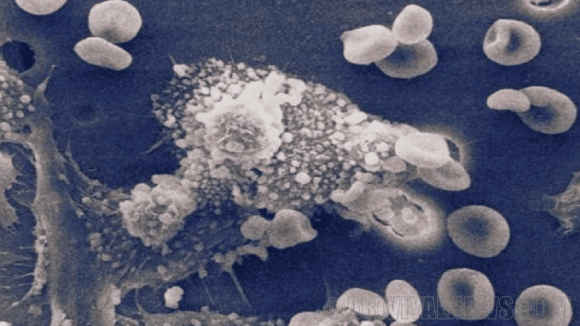 Finds white blood cells eliminate cancer Finds white blood cells eliminate cancer