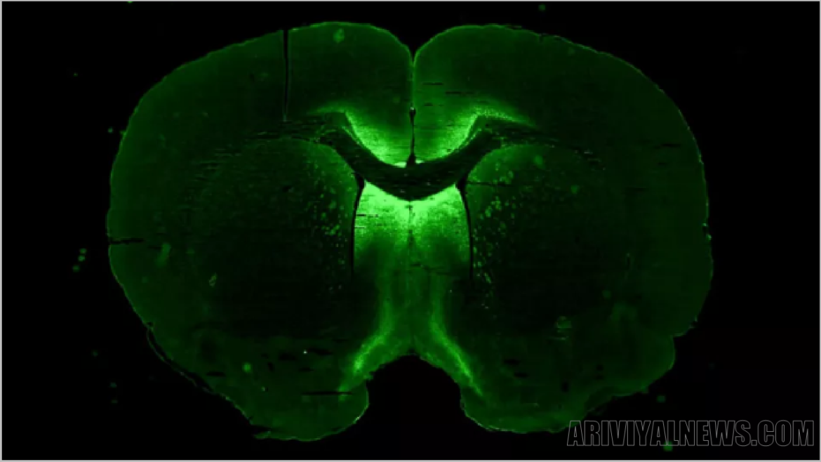Spherical minibrains