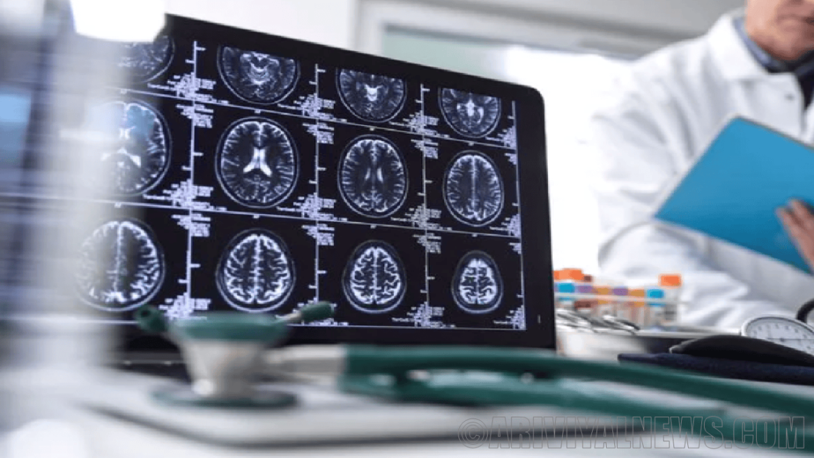 The alzheimers drugs